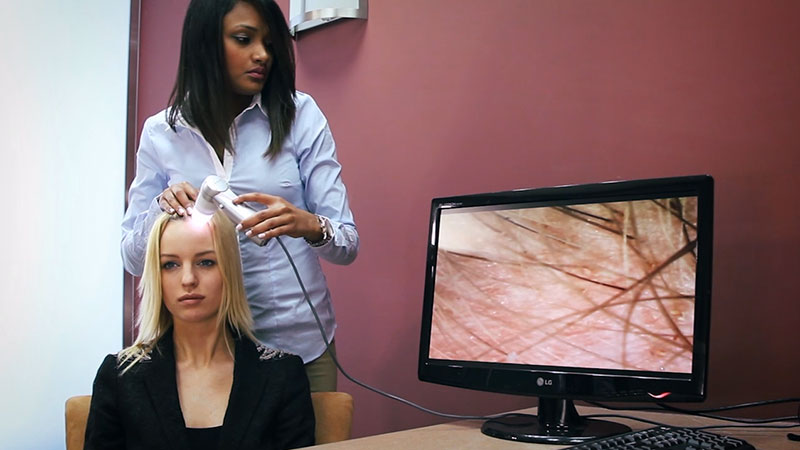 Scalp scope consultation with a client and a monitor displaying a magnified scalp image